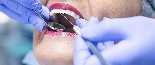 Best Emergency Treatment for Dental Infections or Abscesses in Buena Vista, MI